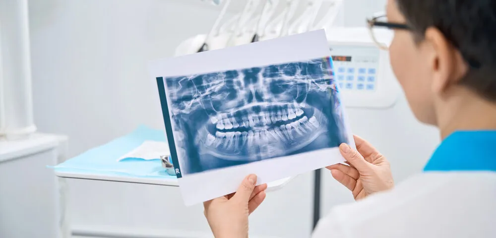 intraoral and extraoral x-rays